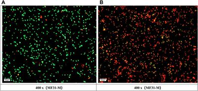 Research on the antibacterial mechanism of medical nanosilver latex composite materials